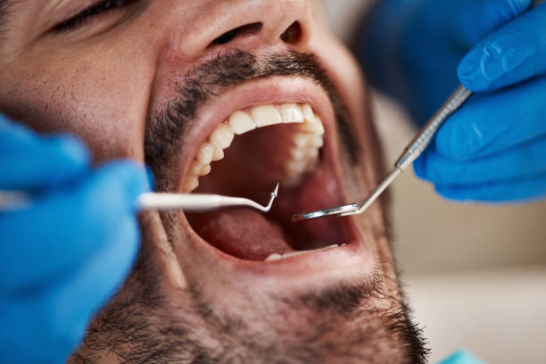 Best Teeth Whitening  in Forsyth, IL